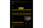 Molecular Sieve Foreline Traps (Catalog F56)